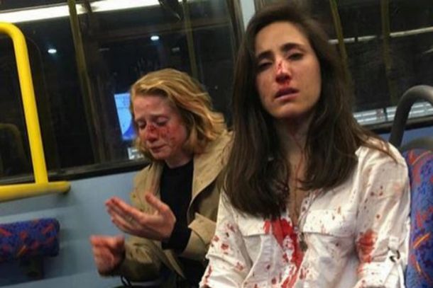 Brutal golpiza contra una pareja de mujeres en Londres: Me partieron la nariz, vi sangre y perdí el conocimiento