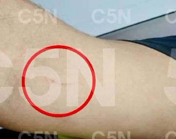 Estas son las marcas que presenta el hombre