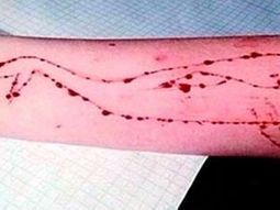 El juego de La Ballena Azul preocupa a Uruguay El juego de La Ballena Azul preocupa a Uruguay