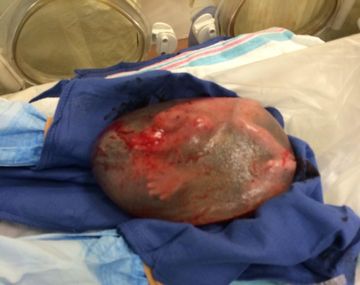 Impresionante video del un bebé naciendo