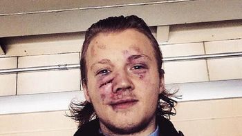 asi quedo tras pelea en partido de hockey asi quedo tras pelea en partido de hockey