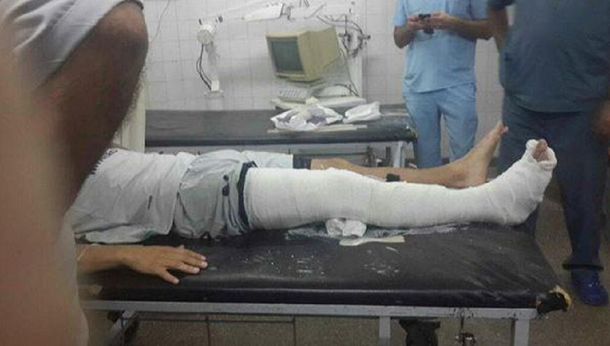 Así quedó Carlos Bueno tras la fuerte patada de Orión