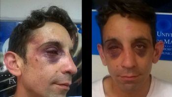 un joven gay denuncia haber sido salvajemente golpeado por una patota neonazi un joven gay denuncia haber sido salvajemente golpeado por una patota neonazi