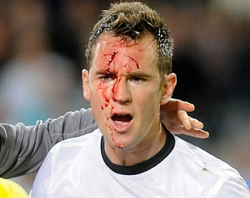 Le dieron un planchazo en la cara pero el árbitro no lo cobró