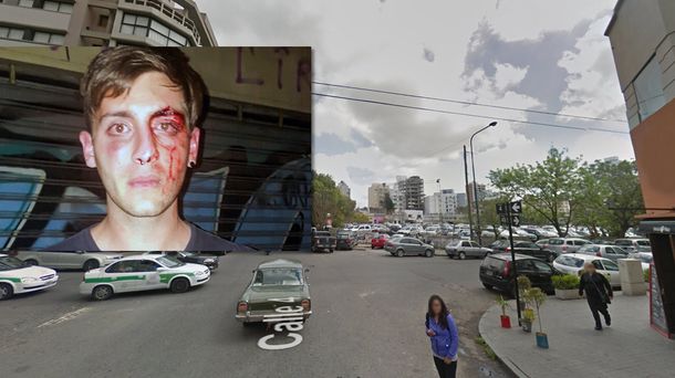 Un joven sufrió una brutal golpiza en una cervecería de La Plata