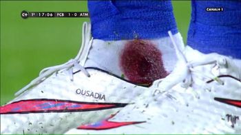 mira como le quedo el tobillo a un crack del barca despues de una patada mira como le quedo el tobillo a un crack del barca despues de una patada