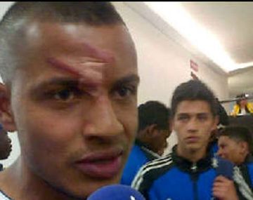 El rostro de Ramírez, tras la agresión de Bedoya.