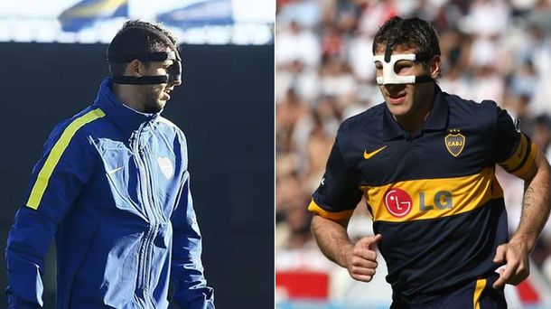 De Palermo a Calleri: cómo les fue a los 9 de Boca cuando usaron máscara