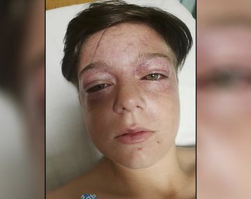 Calesita de la muerte: el nuevo y desafío viral que alarma