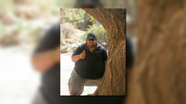 Murió un joven de 28 años con obesidad mórbida que pesaba 260 kilos