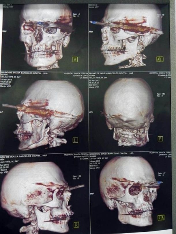 El hombre se salvó de milagro