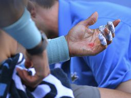 asi esta la mano de nadal antes de enfrentar a federer asi esta la mano de nadal antes de enfrentar a federer