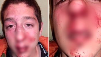 insolito: patovicas le pegaron por error y le dieron entradas gratis como disculpas insolito: patovicas le pegaron por error y le dieron entradas gratis como disculpas