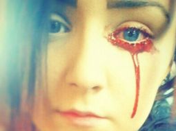 una adolescente de inglaterra no para de sangrar por los ojos y no saben por que una adolescente de inglaterra no para de sangrar por los ojos y no saben por que