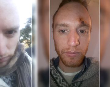 Brutal agresión a un hombre por ser gay