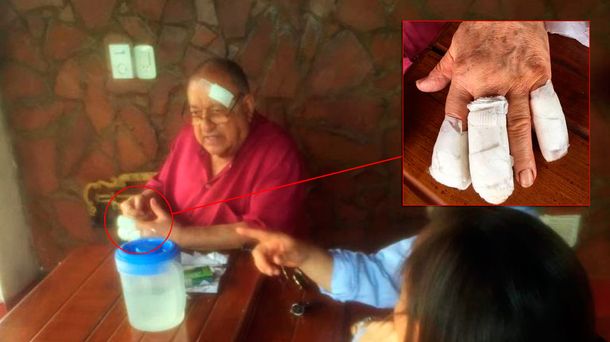 Así le dejaron la mano al juez que fue asaltado y torturado en Misiones