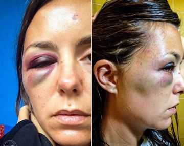 Una turista argentina fue golpeada