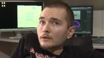 el primer trasplante de cabeza el primer trasplante de cabeza