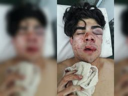 El adolescente de 18 años terminó internado