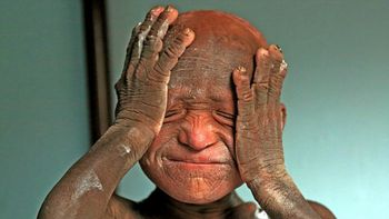 el extrano caso del nene que se esta convirtiendo en piedra el extrano caso del nene que se esta convirtiendo en piedra