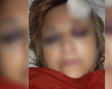 Atacó a batazos a los padres de una chica a la que violó cuando era una niña