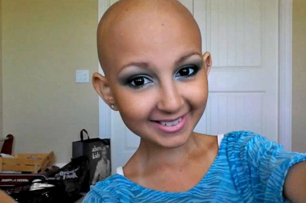 Muere una estrella de YouTube tras luchar contra el cáncer