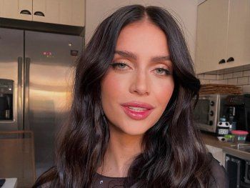 El accidente de Zaira Nara: La belleza duele