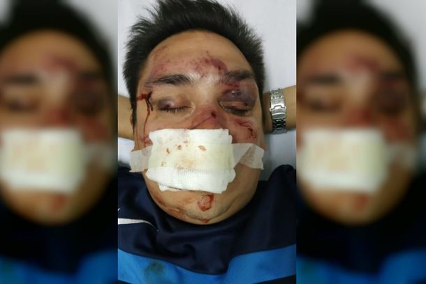 Sebastián Acosta fue brutalmente agredido por barras bravas de Rcaing.