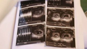 Yanina y Matías serán padres primerizos Yanina y Matías serán padres primerizos