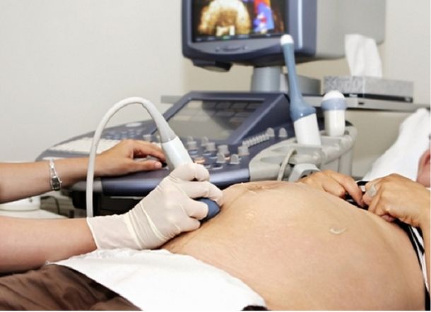 Pícaros: le cobran el doble una ecografía a una embarazada porque está esperando mellizas