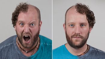 los genes mandan: mira estas fotos los genes mandan: mira estas fotos