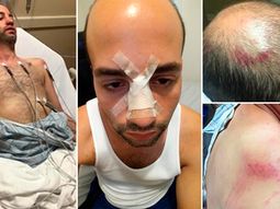 VIDEO: un hombre denunció que un grupo de policías le dio una paliza por ser gay