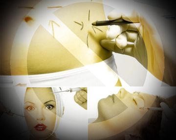 Polémica por el proyecto que prohíbe las cirugías estéticas a menores