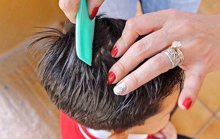 Traer dos piojos vivos, la desagradable tarea que una maestra les dio a sus alumnos