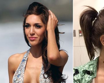 Estrella fue víctima de mala praxis