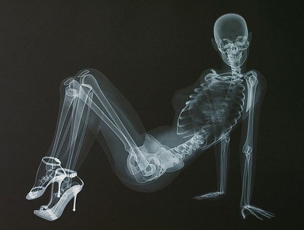 Modelos desnudas y muy sexys a través de rayos x