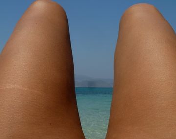 Mujeres en alerta: 5 mitos comunes sobre las estrías