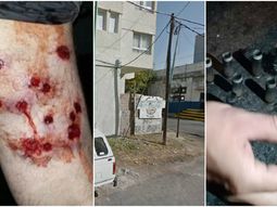 Dos mujeres baleadas en el barrio de La Boca Dos mujeres baleadas en el barrio de La Boca