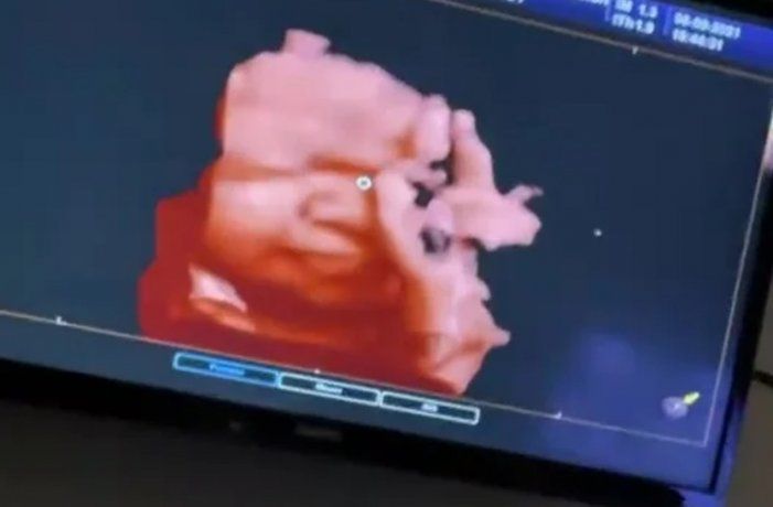 L-Gante compartió la foto más tierna de su vida