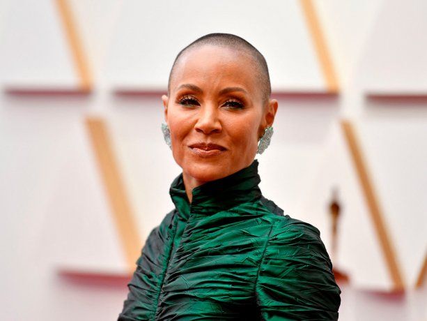 Qué es la alopecia, la enfermedad que padece Jada Pinkett, y por la que Will Smith golpeó a Chris Rock