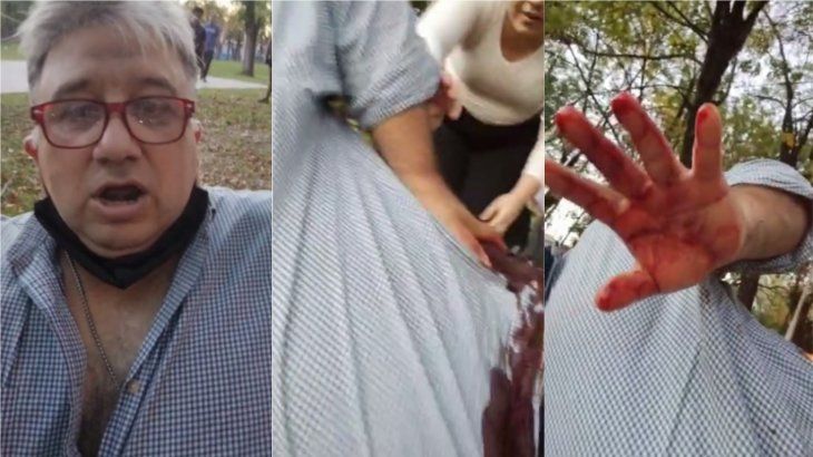 José C. Paz: balearon a un periodista para robarle la camioneta