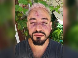 Franco Ruiz, víctima de un ataque homofóbico en Chaco