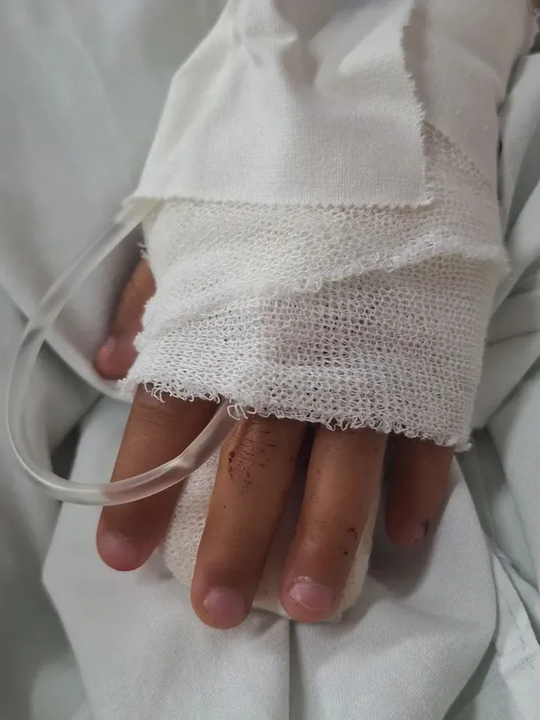 La nena se arrojó del auto en movimiento para escapar y sufrió lesiones. Foto: TN. La nena se arrojó del auto en movimiento para escapar y sufrió lesiones. Foto: TN.