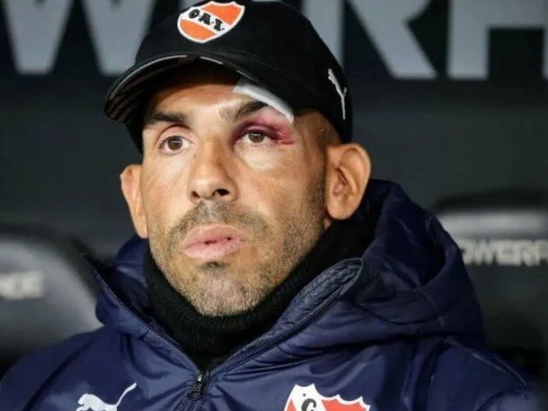 La broma de Carlos Tevez sobre el accidente doméstico que sufrió