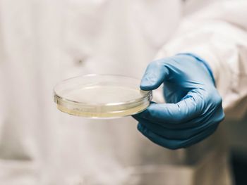 Desarrollaron un método para prevenir el&nbsp;Síndrome Urémico Hemolítico (SUH)