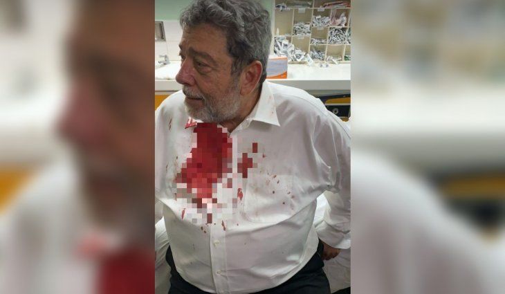 Hieren a un Primer Ministro en una protesta anti vacunación contra el Covid-19