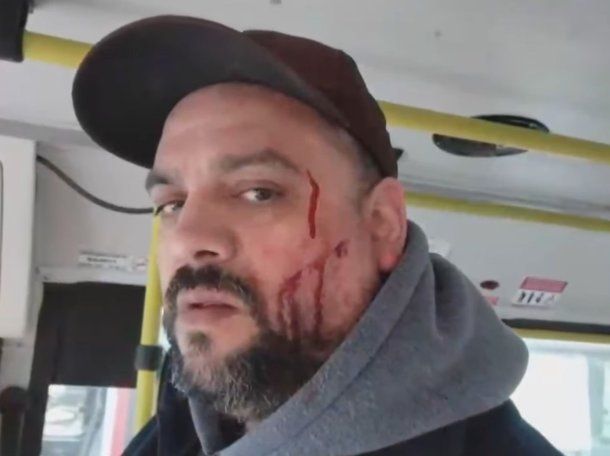 Moreno: quisieron viajar con un certificado trucho y le desfiguraron la cara a un colectivero