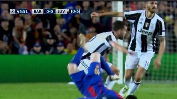 El feo golpe que sufrió Lionel Messi ante Juventus El feo golpe que sufrió Lionel Messi ante Juventus