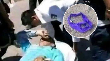 insolito: un motociclista choco en medio de la ruta por culpa de una tanga voladora insolito: un motociclista choco en medio de la ruta por culpa de una tanga voladora