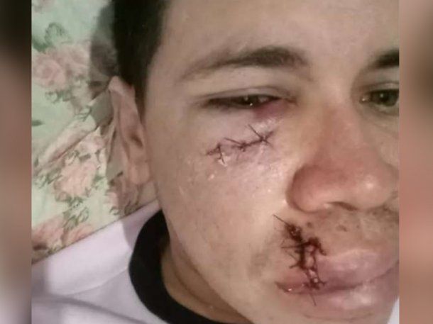 Un jugador de futsal quedó inconsciente tras recibir un cabezazo